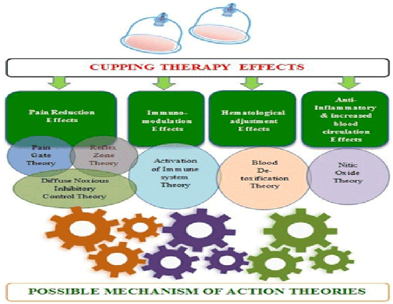 The medical perspective of cupping therapy Effects and mechanisms of action Chrissy Stites LMT